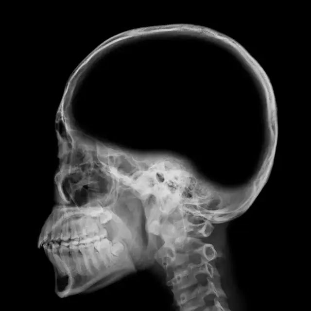 Side view X-ray of a human skull and upper vertebrae for personal development insights.